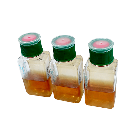Waarom is de selectie van een geschikt microbiologisch kweekmedium zo belangrijk voor de diagnose?