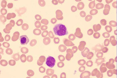 Babio lanceert hoogwaardige Giemsa-vlekoplossing voor wereldwijde laboratoria