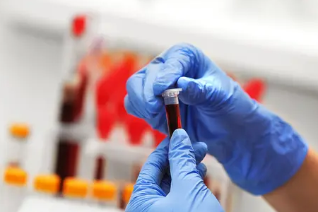 Snelle malariadetectie: BABIO’s dubbele antigeentestkit ondersteunt de mondiale gezondheidszorg