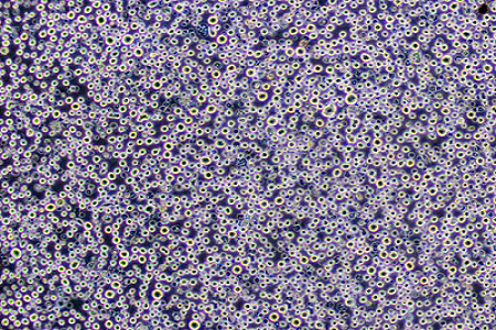 Bevordering van de identificatie van enterische pathogenen met TSI Agar